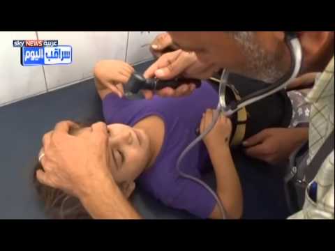 وفاة 40 طفلًا في إدلب  بلقاح مضاد للحصبة