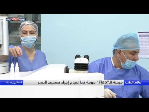 تفاصيل تقنية الفيمتو ليزر وتصحيح البصر