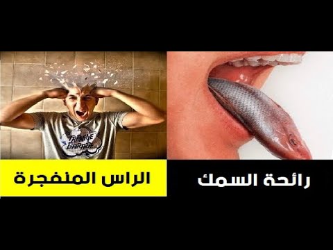 13 مرضًا غريبًا لم تكن تعرفهم