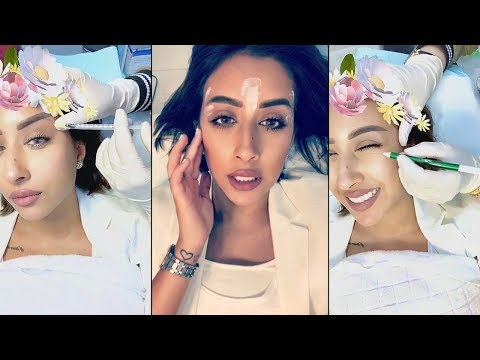 فرح الهادي تجري جرحة ليزر وبوتكس للوجه