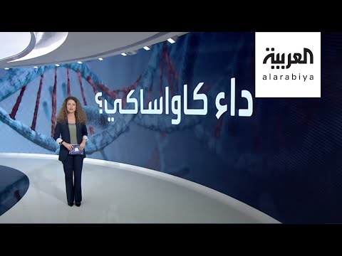 لماذا عاد مرض كاواساكي ليصيب أطفال العالم بالتزامن مع كورونا