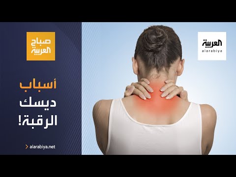 شاهد تعرّف على أسباب ديسك الرقبة وطرق علاجه