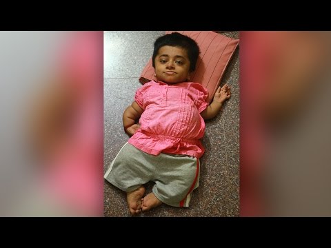 هندية تبلغ 19 عامًا ومحبوسة فى جسد طفلة