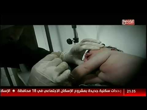 يتعرّض للضرب المُبرِح لمدة 18 دقيقة متواصلة