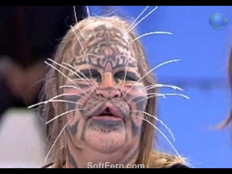 أبشع عمليات التجميل حول العالم