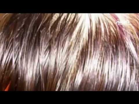 فروة الشعر الدهنية محرجة صيفا