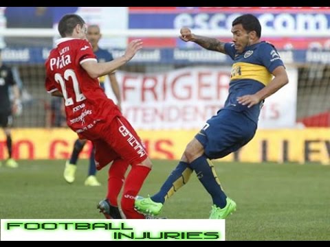 عمليات كسر الأقدام فى الملاعب