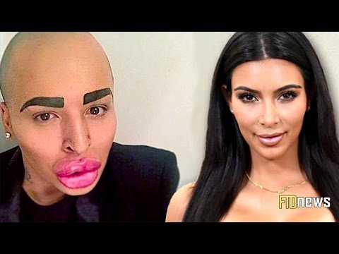 مواطنون يجرون عمليات تجميل للتشبّه بالمشاهير